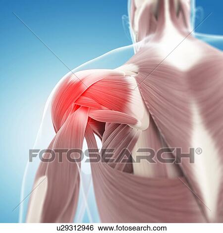 Shoulder pain, conceptual artwork View Large Illustration Stock Illustration - Shoulder pain, conceptual artwork. Fotosearch
