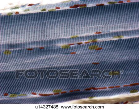 Skeletal muscle fibres, light micrograph View Large Illustration Stock Illustration - Skeletal muscle fibres, light micrograph. Fotosearch