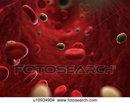 Stock Illustration - Smallpox infection, artwork. Fotosearch