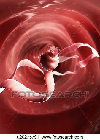 Clip Art - Tapeworm, artwork. Fotosearch
