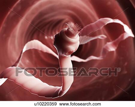 Stock Illustration - Tapeworm, artwork. Fotosearch