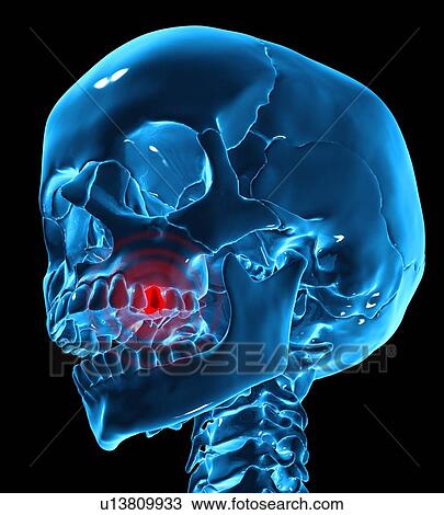 Drawing - Toothache, conceptual artwork. Fotosearch