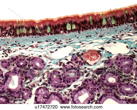 Clipart - Trachea, light micrograph. Fotosearch