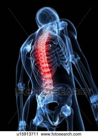 Back pain, conceptual artwork View Large Illustration Clip Art - Back pain, conceptual artwork. Fotosearch