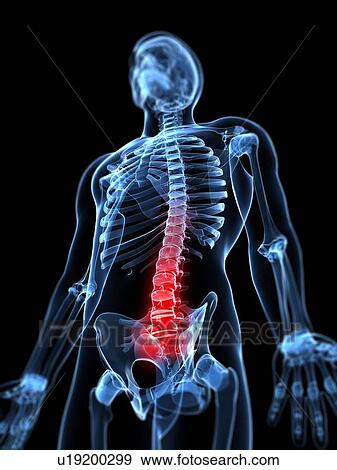 Lower back pain, conceptual artwork View Large Illustration Stock Illustration - Lower back pain, conceptual artwork. Fotosearch
