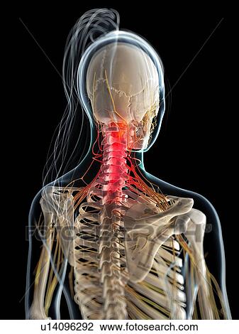 Neck pain, conceptual artwork View Large Illustration Drawing - Neck pain, conceptual artwork. Fotosearch