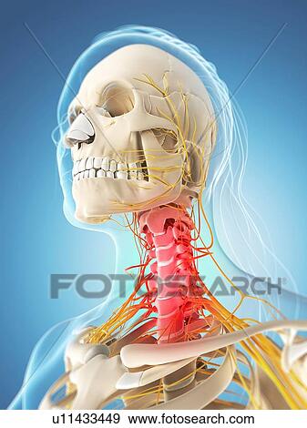 Stock Illustration - Neck pain, conceptual artwork. Fotosearch