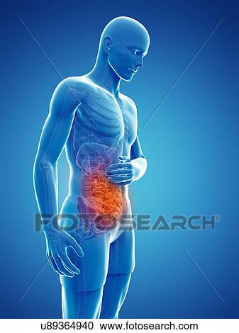 Abdominal pain, artwork View Large Illustration Clipart - Abdominal pain, artwork. Fotosearch