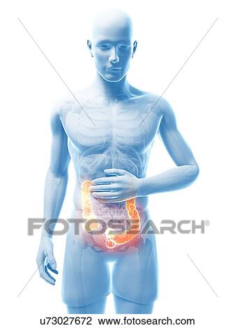 Abdominal pain, artwork View Large Illustration Drawing - Abdominal pain, artwork. Fotosearch