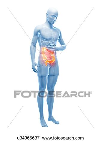 Abdominal pain, artwork View Large Illustration Stock Illustration - Abdominal pain, artwork. Fotosearch