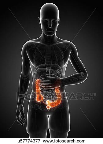 Stock Illustration - Abdominal pain, artwork. Fotosearch