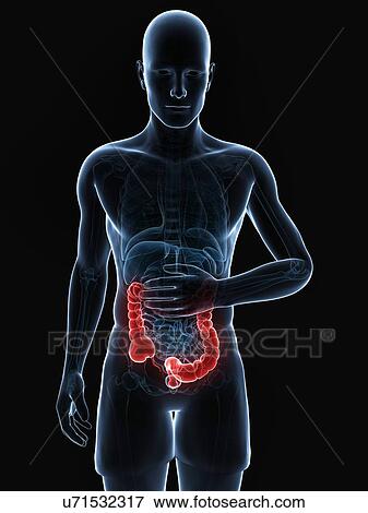 Abdominal pain, artwork View Large Illustration Stock Illustration - Abdominal pain, artwork. Fotosearch