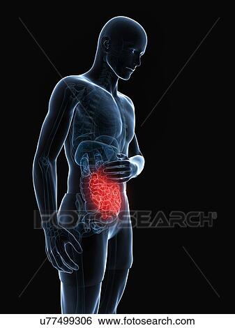 Abdominal pain, artwork View Large Illustration Stock Illustration - Abdominal pain, artwork. Fotosearch