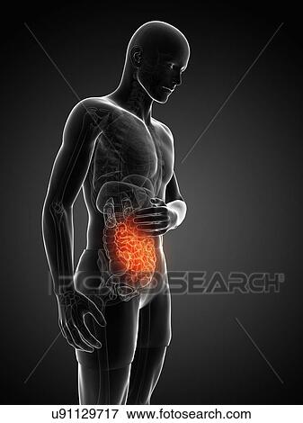 Abdominal pain, artwork View Large Illustration Stock Illustration - Abdominal pain, artwork. Fotosearch