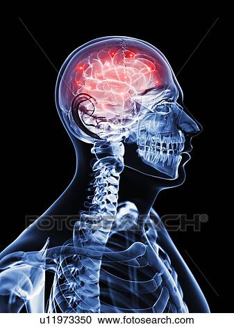 Clipart - Active brain, artwork. Fotosearch