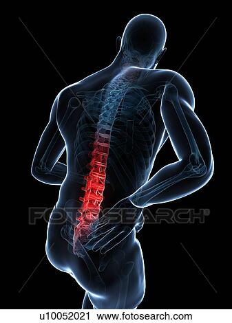 Back pain, artwork View Large Illustration Clip Art - Back pain, artwork. Fotosearch