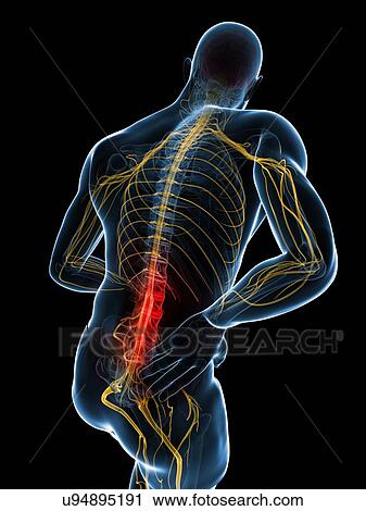 Back pain, artwork View Large Illustration Clip Art - Back pain, artwork. Fotosearch