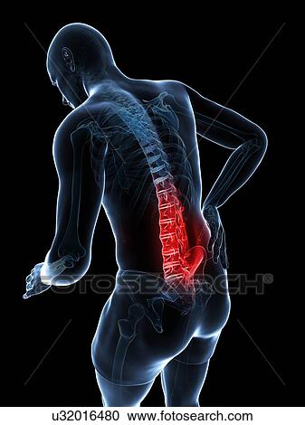Back pain, artwork View Large Illustration Clipart - Back pain, artwork. Fotosearch