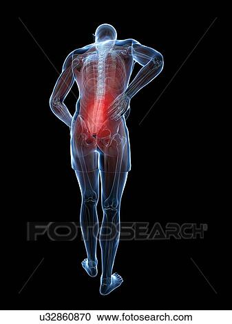 Back pain, artwork View Large Illustration Clipart - Back pain, artwork. Fotosearch