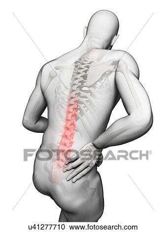 Back pain, artwork View Large Illustration Clipart - Back pain, artwork. Fotosearch