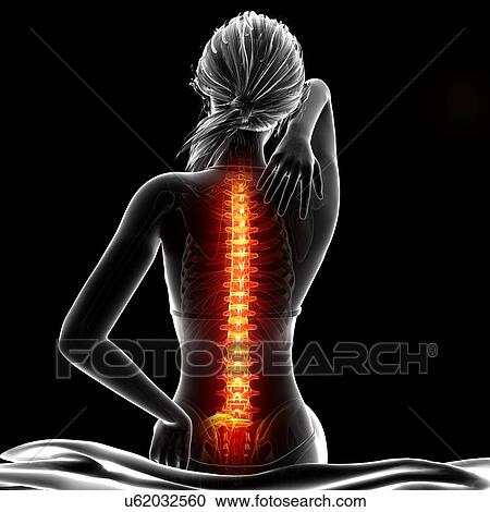 Back pain, artwork Clipart | u62032560 | Fotosearch