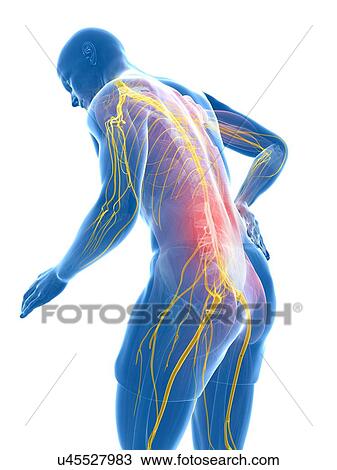 Drawing - Back pain, artwork. Fotosearch