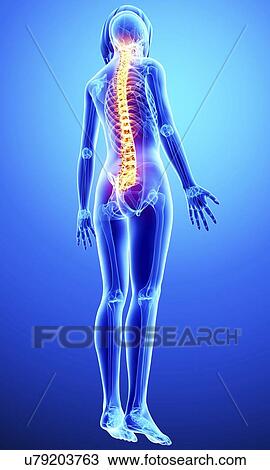 Drawing - Back pain, artwork. Fotosearch
