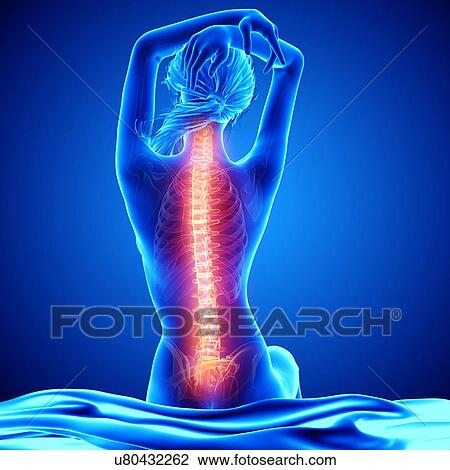 Back pain, artwork View Large Illustration Drawing - Back pain, artwork. Fotosearch
