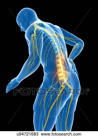 Drawing - Back pain, artwork. Fotosearch