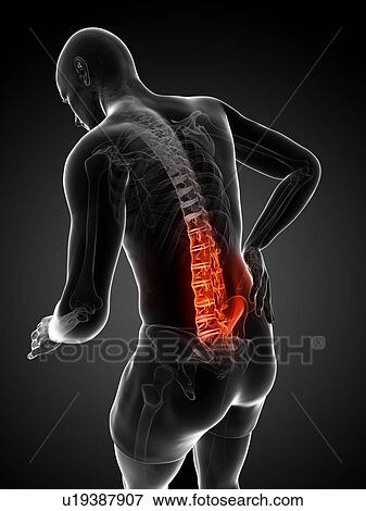 Back pain, artwork View Large Illustration Stock Illustration - Back pain, artwork. Fotosearch