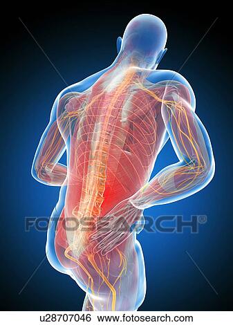 Stock Illustration - Back pain, artwork. Fotosearch