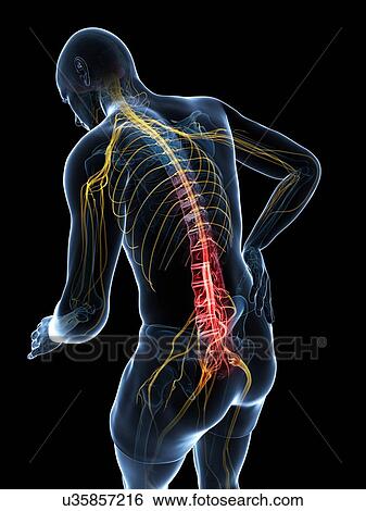 Back pain, artwork View Large Illustration Stock Illustration - Back pain, artwork. Fotosearch