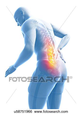 Back pain, artwork View Large Illustration Stock Illustration - Back pain, artwork. Fotosearch