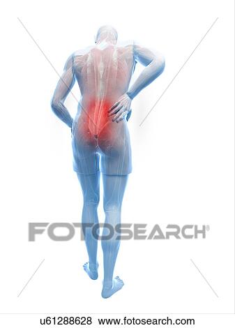 Back pain, artwork View Large Illustration Stock Illustration - Back pain, artwork. Fotosearch