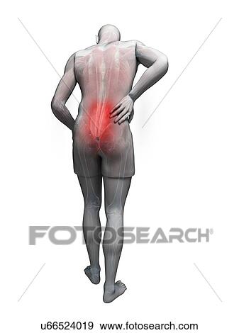 Stock Illustration - Back pain, artwork. Fotosearch