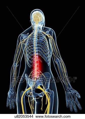 Back pain, artwork View Large Illustration Stock Illustration - Back pain, artwork. Fotosearch