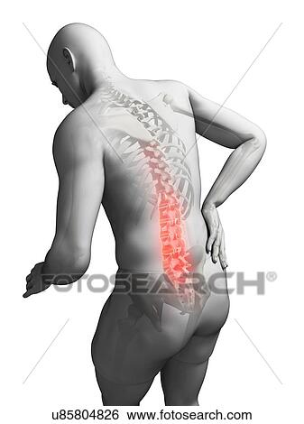 Back pain, artwork View Large Illustration Stock Illustration - Back pain, artwork. Fotosearch