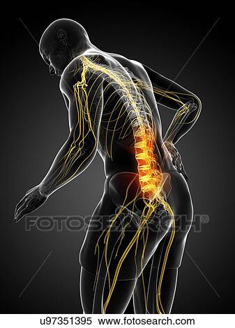 Back pain, artwork View Large Illustration Stock Illustration - Back pain, artwork. Fotosearch