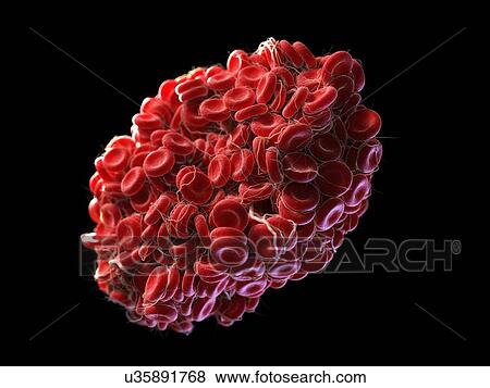 Stock Illustration - Blood clot, artwork. Fotosearch