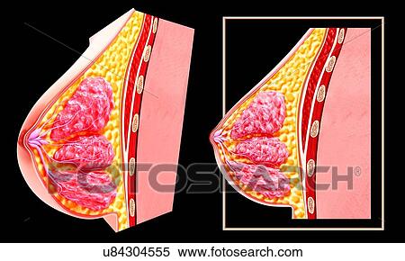 Breast anatomy, artwork View Large Illustration Stock Illustration - Breast anatomy, artwork. Fotosearch