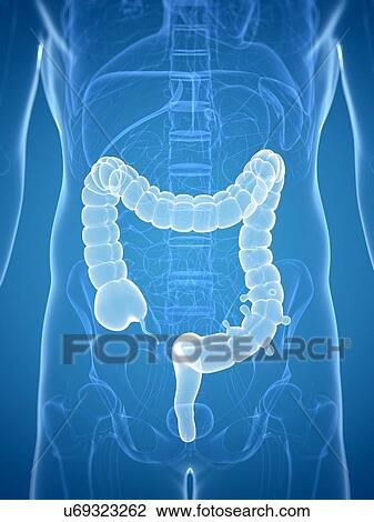 Drawing - Colon diverticuli, artwork. Fotosearch