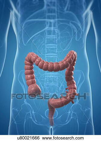 Colon diverticuli, artwork View Large Illustration Stock Illustration - Colon diverticuli, artwork. Fotosearch