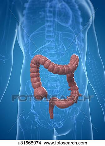 Colon diverticuli, artwork View Large Illustration Stock Illustration - Colon diverticuli, artwork. Fotosearch