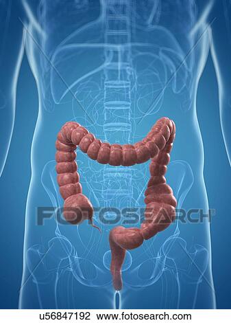 Drawing - Colon obstipation, artwork. Fotosearch