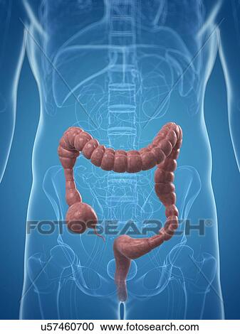 Colon spasms, artwork View Large Illustration Clipart - Colon spasms, artwork. Fotosearch