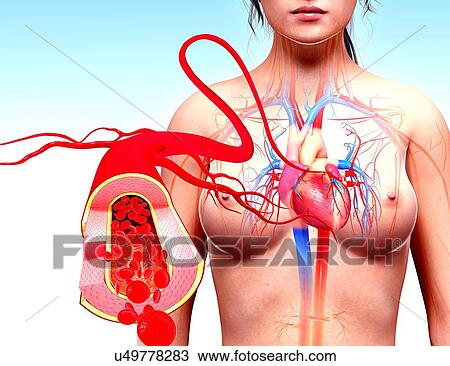 Female cardiovascular system, artwork View Large Illustration Drawing - Female cardiovascular system, artwork. Fotosearch