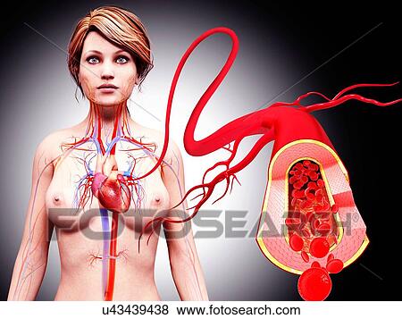 Female cardiovascular system, artwork View Large Illustration Stock Illustration - Female cardiovascular system, artwork. Fotosearch