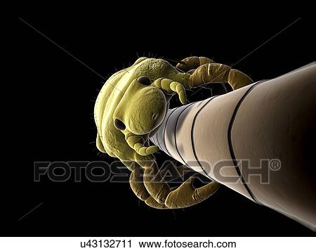 Head louse, artwork View Large Illustration Clip Art - Head louse, artwork. Fotosearch