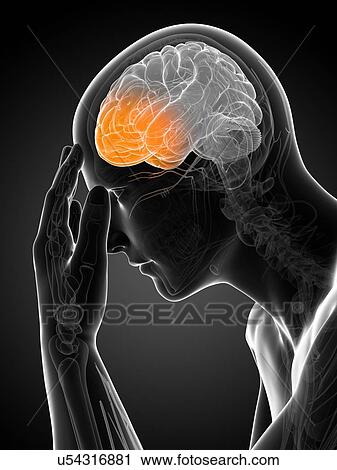 Clip Art - Headache, artwork. Fotosearch
