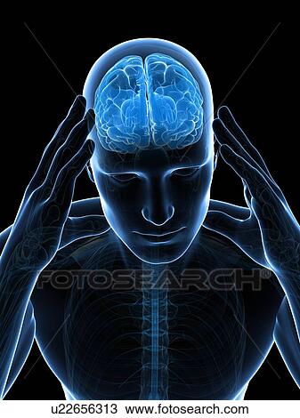 Drawing - Headache, artwork. Fotosearch